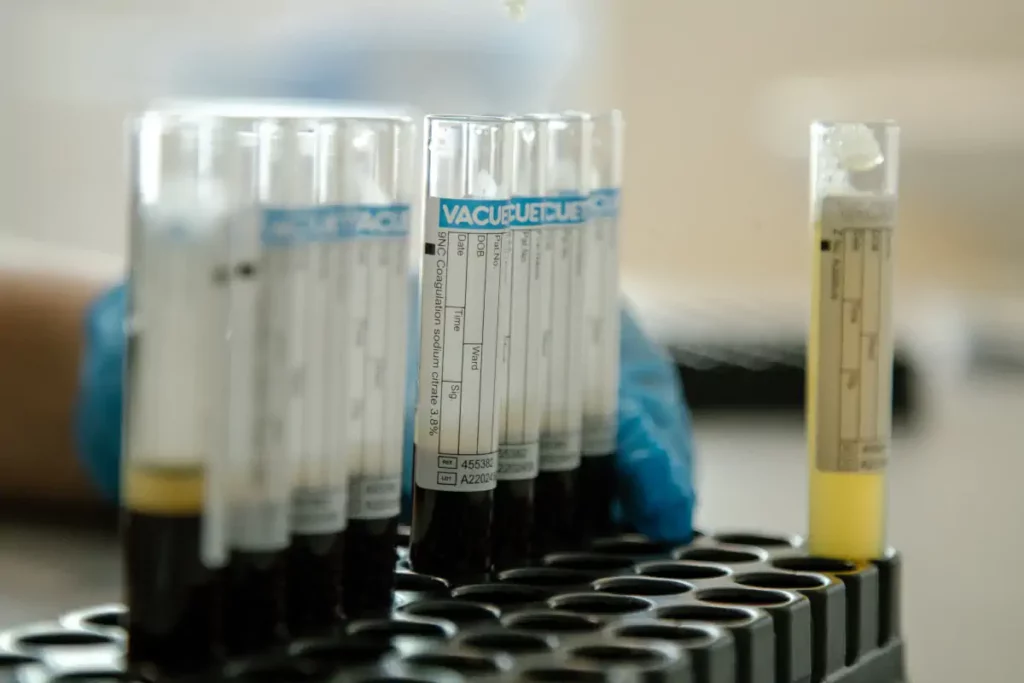 Инъекции обогащённой тромбоцитами плазмы